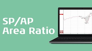 Using the SPAP Area Ratio for Diagnosis of Menieres Disease [upl. by Ebanreb]