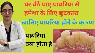 Periodontitis पायरियापायरिया क्या होता है इसके कारण और इलाज what is pyorrhea [upl. by Cavan379]