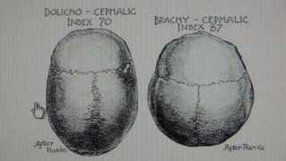 Swiss have Khazarian Brachycephalic Craniometry Cephalometry from Central Asia Mongolia [upl. by Aislehc]