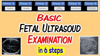 Basic Fetal Ultrasound Examination [upl. by Seaton235]