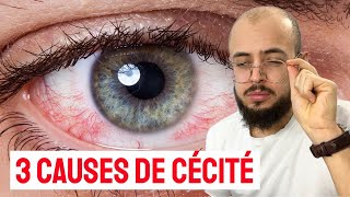 Les 3 grandes causes de PERTE DE VUE à lâge adulte [upl. by Ybba]