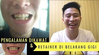 Pengalaman Dikawat dan Retainer yang di Belakang Gigi GA KELIATAN [upl. by Deacon]