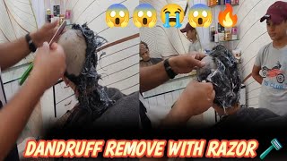 Dandruff 😱 head shaving india 😱🔥💯dandruff head clean shave 😱 Pimple Head shaved [upl. by Nilknarf]