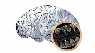 Inside the autism brain The cerebellum [upl. by Joash]