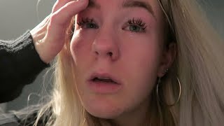 ALLERGISCHE REACTIE😵 DAILY VLOG 148❤️ [upl. by Aehtna777]