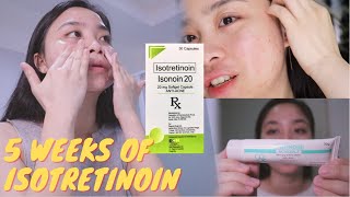 🌜MY NIGHT TIME SKINCARE ROUTINE with Tretinoin  5 WEEKS Isotretinoin Update 🌛 [upl. by Malkin712]