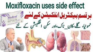 moxifloxacin 400 mg uses in urdu moxifloxacin 400 mg  Mofest 400mg  X gen 400mg  Avelox 400mg [upl. by Elyn]