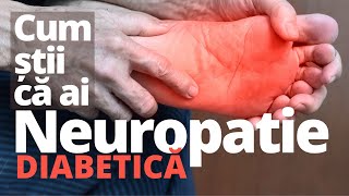 Cum știi SIGUR că ai NEUROPATIE diabetică [upl. by Solim]