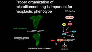 J WardwellOzgo A kinomewide RNAi screen reveals Stk17A drives neoplastic glial proliferation [upl. by Nuahsyar]