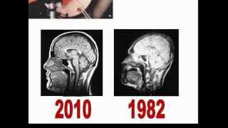 MRI Basics 1 شرح الرنين المغناطيسي [upl. by Jaime]