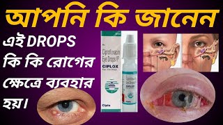 CIPLOX EYE DROPS USE IN BANGLA চোখের যাবতীয় সমস্যার এই ড্রোপস ব্যাবহার করুন। [upl. by Corliss]