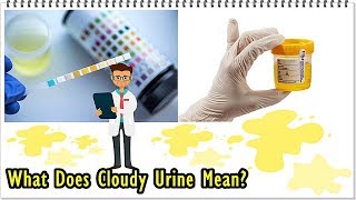 Cloudy Urine  Meaning and Causes of Turbid Pee [upl. by Farrel]