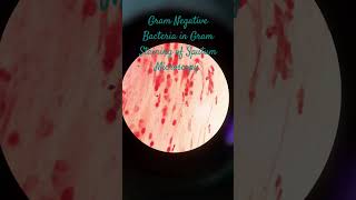 Gram Negative Bacteria in Gram Staining of Sputum Microscopy at various magnifications [upl. by Bobbye388]