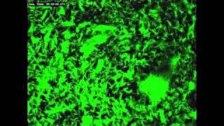 Glowing Mycobacteria [upl. by Ebenezer]