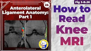 Fig 3B26 Anterolateral Ligament Anatomy [upl. by Findlay227]