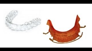 Vivera Retainers  Invisalign Orthodontic Retainers [upl. by Annovad]