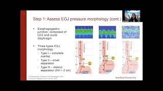 ANMS Clinical Virtual Webinar  Esophageal Manometry When Why and How [upl. by Akeirahs]