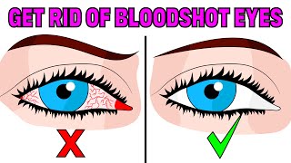 How to Fix Tired amp Red Bloodshot Eyes in 5 Easy Steps [upl. by Joeann]