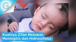 Perjuangan Bayi Zifan Melawan Meningitis dan Hidrosefalus [upl. by Akemat316]