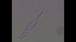 Feeding bdelloid rotifer [upl. by Kelwin924]