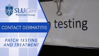 Patch Testing and Treatment for Contact Dermatitis  SLUCare Dermatology [upl. by Ahsemit]