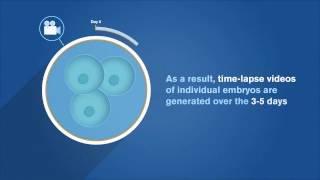 EmbryoScope Patient Information [upl. by Ehtiaf]