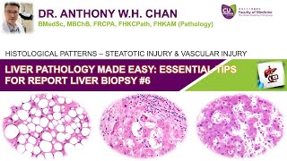 Liver Pathology Made Easy 67  Essential Tips for Reporting Medical Liver Biopsy [upl. by Maddy]