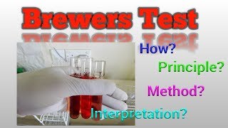 Brewers Test G6PD deficiency [upl. by Retsevel456]