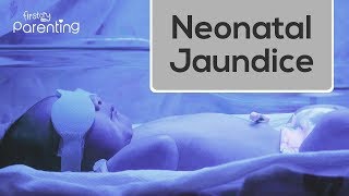 Neonatal Jaundice  Causes Symptoms and Treatment [upl. by Florence]