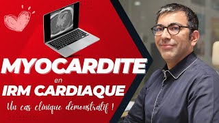 Myocardite en IRM cardiaque  tout comprendre en 15 minutes [upl. by Aerdnaed]