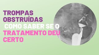 Trompas obstruídas como saber se o tratamento deu certo [upl. by Richers]