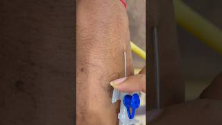 LOCATING DIFFICULT VEINS FOR IV CANNULATION  IV CANNULA [upl. by Agneta212]