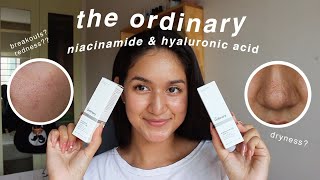 the ordinary niacinamide and hyaluronic acid 1 MONTH review with BEFOREAFTER [upl. by Seth58]