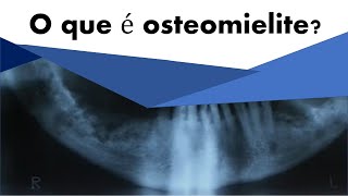 O que é osteomielite  Odontologia  Dra Bianca Rosa [upl. by Wager]