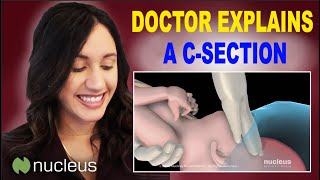 Doctor Uses 3D Animation to Explain CSection [upl. by Naynek311]