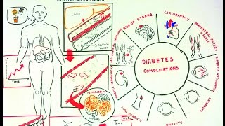 Advanced Glycosylation End Products and Diabeteic complications [upl. by Newol336]