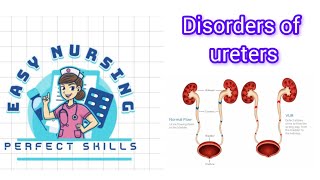 Disorders of ureters ureteral obstruction vesicoureteral reflux  ureteral striture  4th sem [upl. by Seda453]