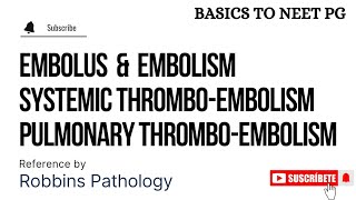 Embolus  Embolism  Part 1  Pulmonary ThromboEmbolism  Systemic ThromboEmbolism  KTC MBBS [upl. by Atsedom]