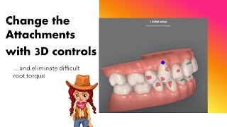 Invisalign ClinCheck  Changing attachments with 3D controls [upl. by Ennasirk]