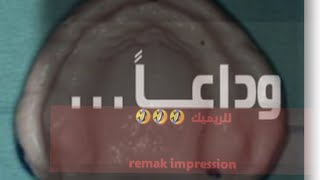 primary impression for edentulous patient [upl. by Nivram359]