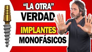 🤔 IMPLANTES DENTALES ESTRATÉGICOS  ¿Son TAN BUENOS los quotNUEVOSquot IMPLANTES MONOFÁSICO sin cirugía [upl. by Amoeji]