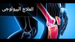 العلاج البيولوجي قصتي مع مرض التهاب الفقار اللاصق والعلاج المذهل الذي اراحني ENBREL 50 mg [upl. by Jabin]