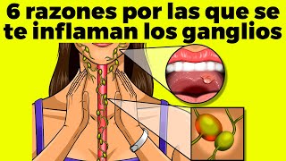 6 RAZONES POR LAS QUE SE TE INFLAMAN LOS GANGLIOS [upl. by Okimik]