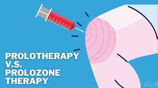 Prolotherapy VS Prolozone Therapy What is the difference and which one is for you [upl. by Vashtee]