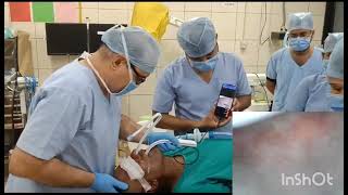 Usefulness of Tascope in restricted mouth opening nasal intubation [upl. by Airot]