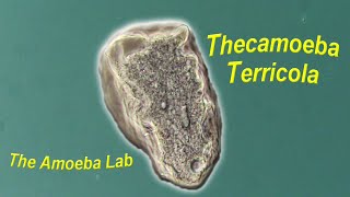 Amoeba  Thecamoeba Terricola by The AmoebaLab [upl. by Noemi]