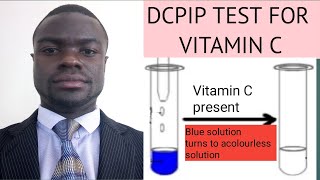 DCPIP TEST FOR VITAMIN C [upl. by Imik]