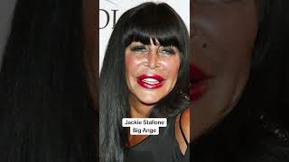 Worst plastic surgery fails foryou celebrities [upl. by Aissenav]