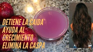 Jugo de Cebolla para la Caída del Cabello y Crecimiento [upl. by Bartosch]