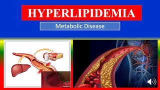 HYPERLIPIDEMIA  Definition types causes pathophysiology signs amp symptoms medicine [upl. by Jacquelin]